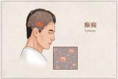 黑龍江省治療癲癇好醫(yī)院